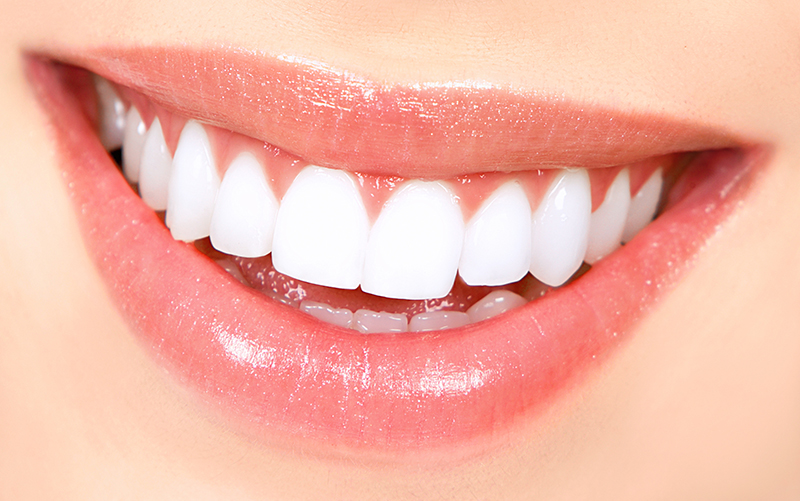 Teeth-Whitening.jpg